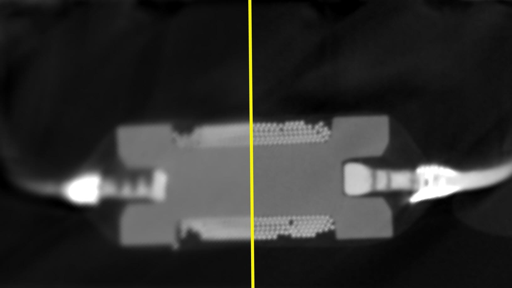 The left side was scanned with "standard" target and right side with "high-flux|target