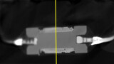 The left side was scanned with "standard" target and right side with "high-flux|target